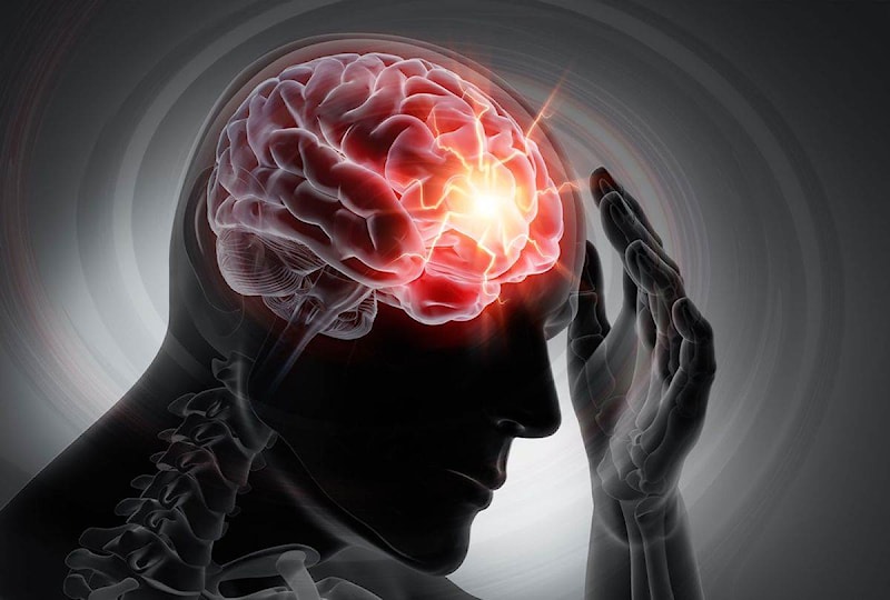 3D render of a man with strong pain in head (Getty Images)