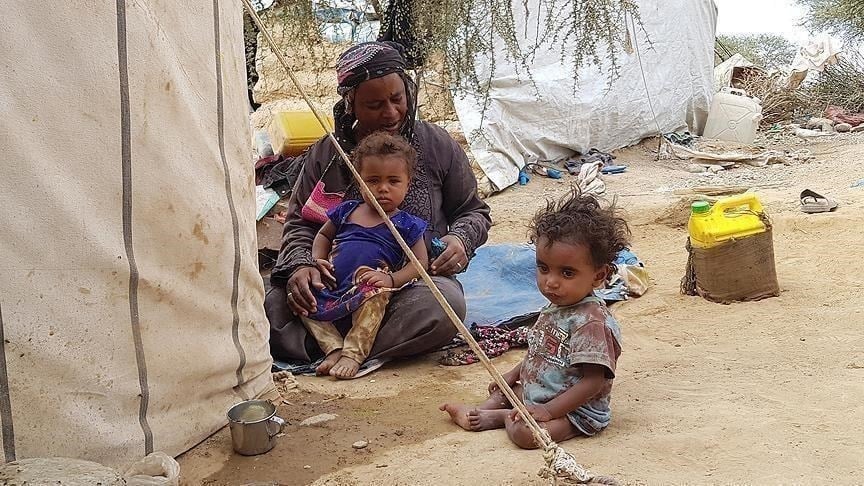 Famine-threatened Yemenis fear impact of sanctions on Russia