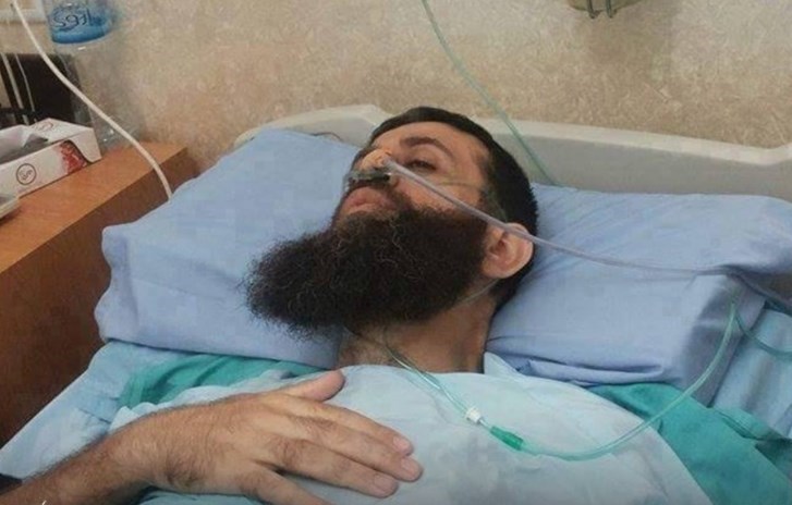 In this image, Palestinian Martyr Khader Adnan is seen suffering from extremely difficult health conditions.in a hospital bed in Israeli prison on his 80th day of hunger strike.